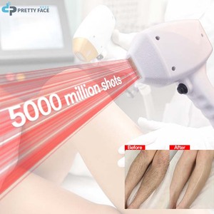 สเปรย์กำจัดขนจากโรงงาน เครื่องเลเซอร์อเล็กซานไดรต์ เครื่องกำจัดขนด้วยเลเซอร์ <span class=keywords><strong>wahl</strong></span> เครื่องกำจัดขนด้วยแว็กซ์แบบมืออาชีพ เลเซอร์ไดโอด - Product Image 6