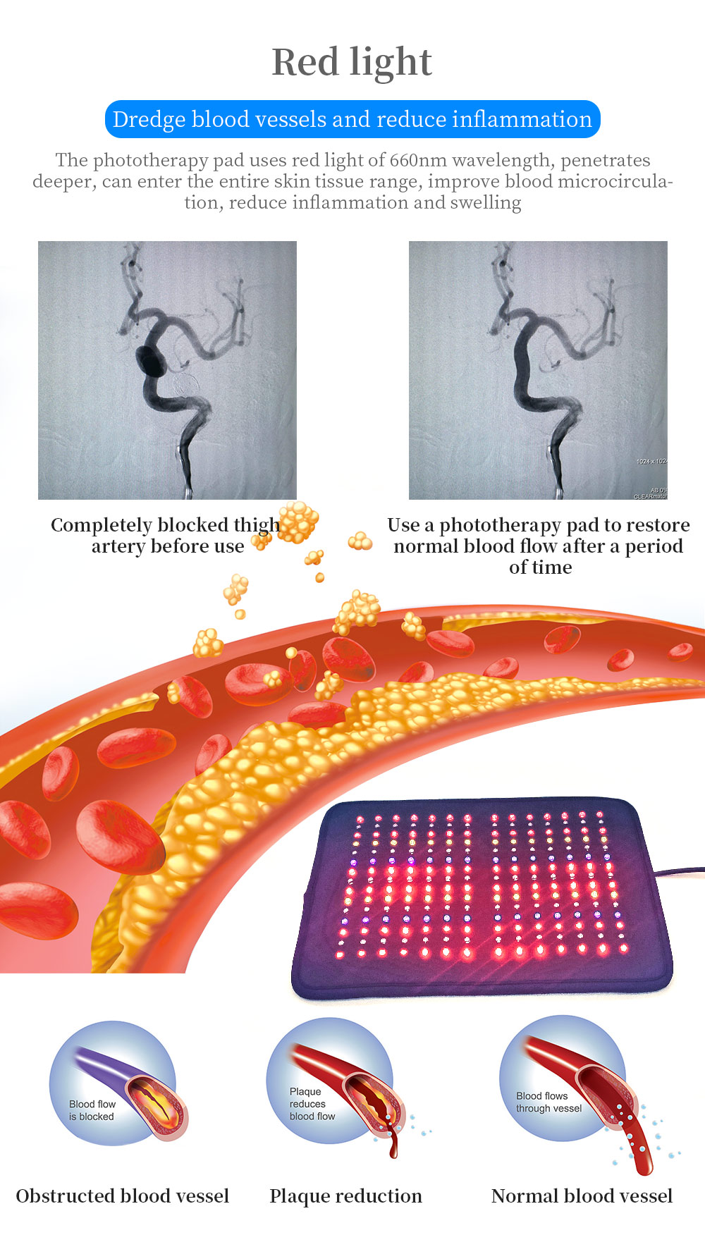 Professional multi wavelengths led near infrared light therapy device pdt treatment infrared pad