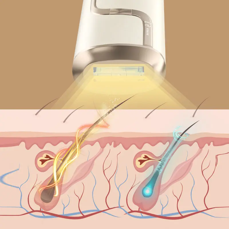 Mini uso domestico portatile multifunzione IPL macchina di ringiovanimento Laser OEM dispositivo di depilazione depilatore per gli uomini