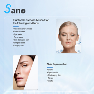 Sano xách tay CO2 fractional máy <span class=keywords><strong>Laser</strong></span> hệ thống trẻ hóa da cho vết sẹo loại bỏ vết rạn da - Product Image 4