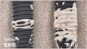 Thiết bị kích hoạt cấy ghép nha khoa Tyris 15s, xử lý bằng phương pháp hydrophilic, phù hợp với hầu hết các thương hiệu Imp. - Product Image 5