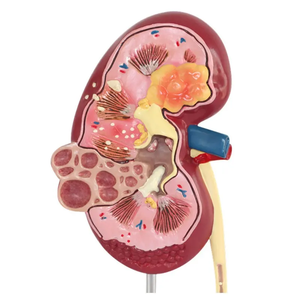 Modèle anatomique d'urologie médicale des fournitures d'enseignement de dispositif de cellule de structure de coeur de maladie rénale
