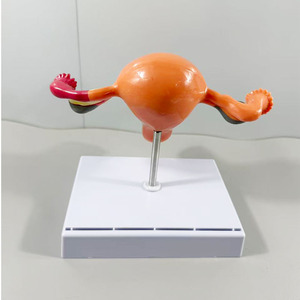 Modello Anatomico del Corpo Umano MAXCARE - Manichino Medico Vaginale, Ovarico e Uterino per l'Insegnamento dei Cambi Patologici in PVC - Product Image 2