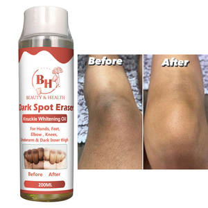 Aceite Blanqueador de Semillas de Vitamina E Frescas de Marca Privada, Reducción Efectiva de Manchas Oscuras, Reducción de Melanina, Blanqueamiento de Piernas y Codos, Esencial Puro - Product Image 5