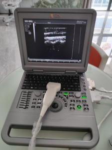 Máquina de Ultrasonido Portátil para <span class=keywords><strong>Embarazo</strong></span> Humano de 12.1 Pulgadas, Imágenes Claras a Color - Product Image 2