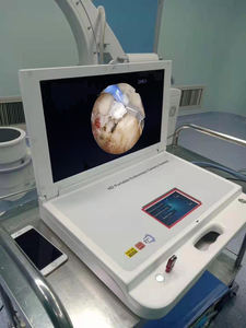 Ensemble d'endoscopie <span class=keywords><strong>Shrek</strong></span>, caméra portable pour ORL - Product Image 6