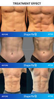 2026 Appareil Portable MDS Flex Shaper le Plus Vendu - Développe les Muscles, Définit la Silhouette, Sublime les Courbes - Pour la Beauté Professionnelle