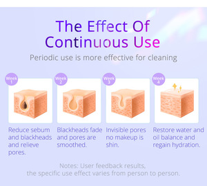 Máquina Facial 6 en 1 de Última Generación, Calma, Repara y Reduce los Poros, Hidrodermoabrasión, Máquina de Cuidado de la Piel para Salón de Belleza - Product Image 4