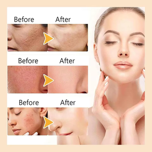 Suero Facial <span class=keywords><strong>Liofilizado</strong></span> con Ácido Hialurónico Antiarrugas, 90 ml, Antienvejecimiento, Aclara Manchas Oscuras en la Piel, Disponible en Stock - Product Image 4