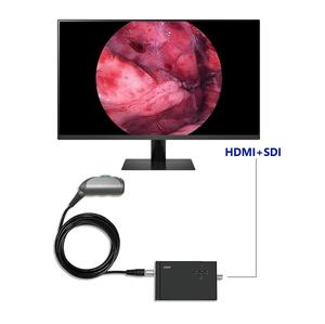 Precio de fábrica Mini 1080P CMOS Procesador de imagen de endoscopio médico portátil para sistema de cámara de endoscopia rígida - Product Image 2