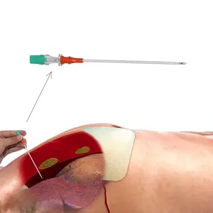 Pneumothorax-Nadel-Trauma Medizinische IFAK-Brust katheter nadel 14G Thorax-Dekompensation nadel