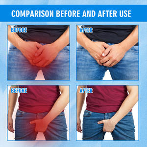 Vente en gros de produits de santé crème antibiotique désodorisante pour l'intérieur des cuisses et anti-démangeaisons pour les parties intimes - Product Image 2