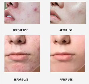 Appareil de soin de la peau pour salon, machine faciale à hydro-oxygène à vision à 360 degrés, 6 poignées, aspiration des points noirs, nettoyage en profondeur - Product Image 6