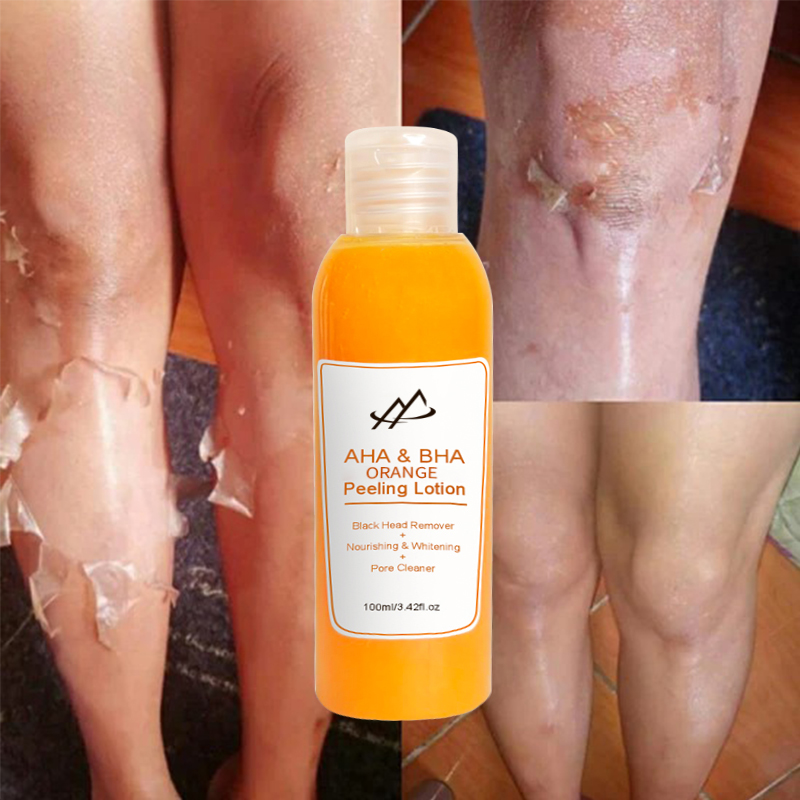 Отшелушивающий лосьон для тела от частного бренда AHA BHA, отбеливающий лосьон для черной кожи, Осветляющий, отшелушивающий, апельсиновый лосьон