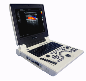 Machine à ultrasons couleur Portable, meilleur <span class=keywords><strong>prix</strong></span> ordinateur Portable couleur Doppler <span class=keywords><strong>Echo</strong></span> Machine pour humain - Product Image 1