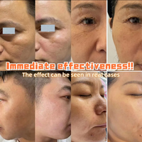 Sérum hydratant anti-âge liftant instantané de haute qualité OEM, au collagène, pour raffermir et resserrer la peau