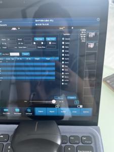 Mesin <span class=keywords><strong>Ultrasound</strong></span> Convex/Linear/Heart kualitas tinggi nirkabel 3 in 1 JM-5 <span class=keywords><strong>Ultrasound</strong></span> <span class=keywords><strong>Probe</strong></span> - Product Image 5