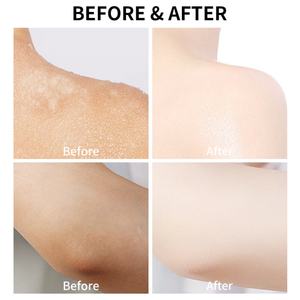 Gommage corporel de haute qualité DIY hydratant et blanchissant, vente en gros, crème gommante blanchissante pour le visage et le corps - Product Image 4