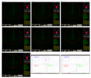 Антенна D511 GNSS с четырьмя спиральными элементами для RTK <span class=keywords><strong>GPS</strong></span> и Beidou, для геодезических работ, 27.5x55.6 мм, разъем SMA, усиление 26 дБи - Product Image 3