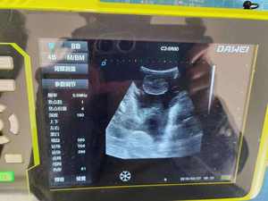 Machine portative imperméable de scanner de système diagnostique vétérinaire d'ultrason de 8 pouces pour des moutons et des chevaux de ferme - Product Image 6