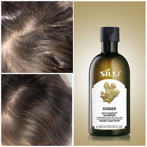 Champú <span class=keywords><strong>para</strong></span> el <span class=keywords><strong>cabello</strong></span>, el <span class=keywords><strong>mejor</strong></span> ajo grueso, totalmente de biotina, colágeno, fuerte, <span class=keywords><strong>para</strong></span> adelgazar el <span class=keywords><strong>cabello</strong></span>, Reino Unido - Product Image 2