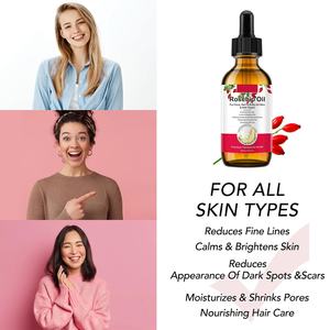 Aceite de rosa mosqueta Natural puro 100% de etiqueta privada, reduce la almeja de línea <span class=keywords><strong>fina</strong></span>, ilumina la piel, elimina las manchas oscuras, cicatriz, reduce los poros, aceite esencial - Product Image 3