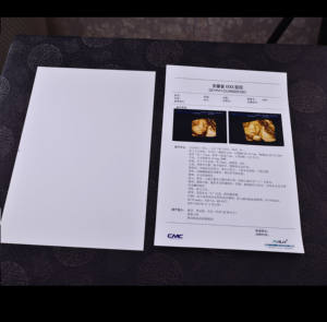 Film jet d'encre blanc 180 microns, film médical, film radiographique, film pour animaux de compagnie pour rapport d'échographie, radiologie - Product Image 4