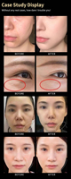 Système de lifting facial et de remodelage corporel 360Pro Desktop ABS Bar, professionnel, anti-âge, raffermissant la peau, régénération du collagène, beauté