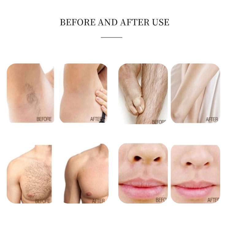 Xinlei beauty machine