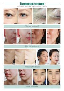 Appareil de soin du visage portable 2025, jet d'eau diamanté, jet d'oxygène, machine de peeling facial sans aiguille, machine de peeling à jet - Product Image 5