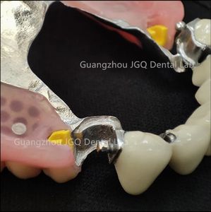 Prothèses dentaires amovibles avec cadre métallique en alliage de cobalt-chrome bonne biocompatibilité pour les humains de laboratoire dentaire de Chine prix bon marché - Product Image 2