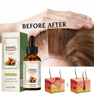 Tratamiento Capilar HQ Mixed Proc Discount, 100% Natural, a Base de Hierbas Orgánicas, con Aceite de Romero y Batana, para el Crecimiento del Cabello - Product Image 3