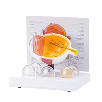 Corneal Eye Medical Anatomical Human Corneal Disease Model TB-03 Human Cataract Eye Anatomical Model Interchangeable Lenses