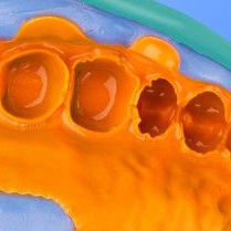 Offre Spéciale Dents Dentaire Mastic D'empreinte Dentaire D'orange Professionnel Ce Approuvé 510K LUMIÈRE Corps Matériau D'empreinte En Silicone - Product Image 4