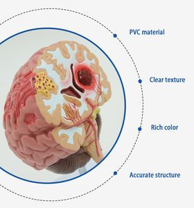 SCIEDU Modelo De Anatomia Do Cérebro Humano Hemorragia Artéria Cerebral Malformação Arteriovenosa Cerebral Patologia Cerebral Modelo Cerebral - Product Image 5
