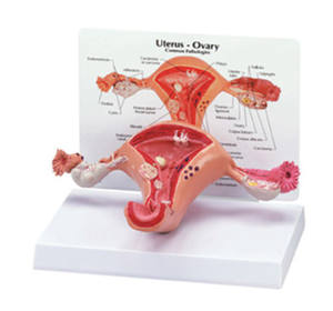 Geavanceerde pvc Vrouwelijke Interne Genitale orgel anatomisch Model - Product Image 1