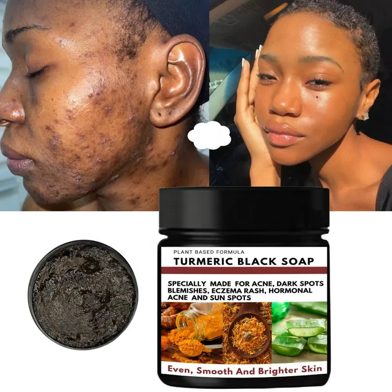 Dark Spot Remover Blemish Soap Turmeric Black Soap Herbal Acne Glowing Skin Black Soap