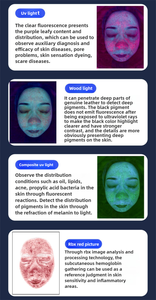 2025 più recente analizzatore per la pelle e il cuoio capelluto ad alta analisi completa definita AI dermascopi Acne talpa macchia corticale umidità Scan - Product Image 5