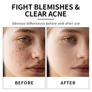 Suero Facial Greenlem con 20% de Vitamina C y E, Antioxidante, Antiarrugas y Blanqueador - Product Image 2