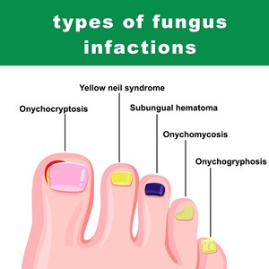 7 jours de soin des ongles au gingembre gris réparation des ongles main pied soin des ongles hydratant crème réparatrice douce - Product Image 5