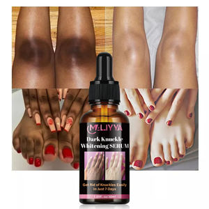 Solo 7 días, nudillos de mano, negro, elimina el Corrector, suero blanqueador de nudillos blanco y oscuro - Product Image 1