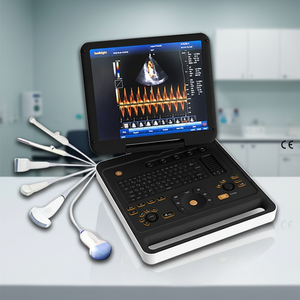 Échographe Doppler Couleur Numérique <span class=keywords><strong>3D</strong></span> Complet pour Ordinateur Portable – Équipement Hospitalier - Product Image 1
