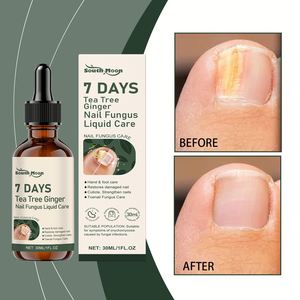 South Moon 30ML Solution Naturelle de Soin des Ongles à Base de Plantes, Spray Doux Anti-Fongique pour Ongles, Infusé à l'<span class=keywords><strong>Huile</strong></span> d'Arbre à Thé et au Gingembre - Product Image 2