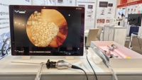 Système de caméra d'endoscopie médicale intégrée Full HD IKEDA avec moniteur 22 pouces et imagerie chirurgicale
