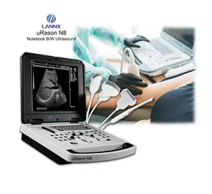 LANNX uRason N8 Custom logos clinic ultrasound Automatic Identification Probe portable USG Ultrasonic Diagnostic scanner