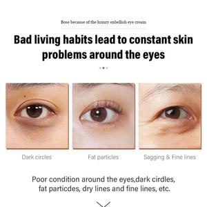 Ventes à bas prix, crème pour les yeux biologique à étiquette privée de 20 g, réduit les cernes, Bose grâce à la crème pour les yeux luxueuse Enbellish - Product Image 2