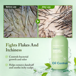 <span class=keywords><strong>Champú</strong></span> y acondicionador para el cabello anticaspa con logotipo personalizado, fábrica Orgainc <span class=keywords><strong>Ayurveda</strong></span>, Limpieza Profunda, Control de aceite, <span class=keywords><strong>champú</strong></span> y acondicionador purificante - Product Image 4