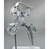 Modèle d'implant de hanche transparent KyrenMed, modèle de remplacement, mini taille, modèle d'affichage générique transparent