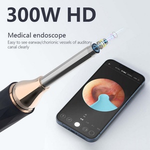 Nettoyeur de cérumen intelligent sans fil pour usage domestique, otoscope portable avec caméra Wi-Fi pour l'élimination visuelle du cérumen - Product Image 2