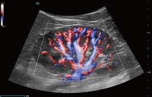 Échographe sur chariot Mindray Consona N7 Doppler couleur avec fonctions intelligentes IA pour un diagnostic automatisé - Product Image 6